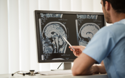 Alzheimer’s Brain Scan Insights: How TMS Supports Early Prevention